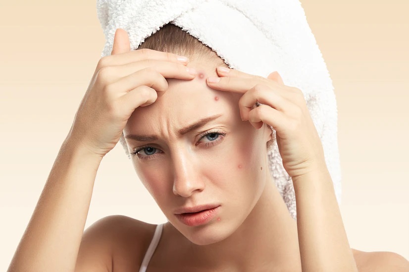 بهترین ژل ضدجوش